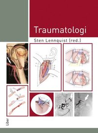 Traumatologi